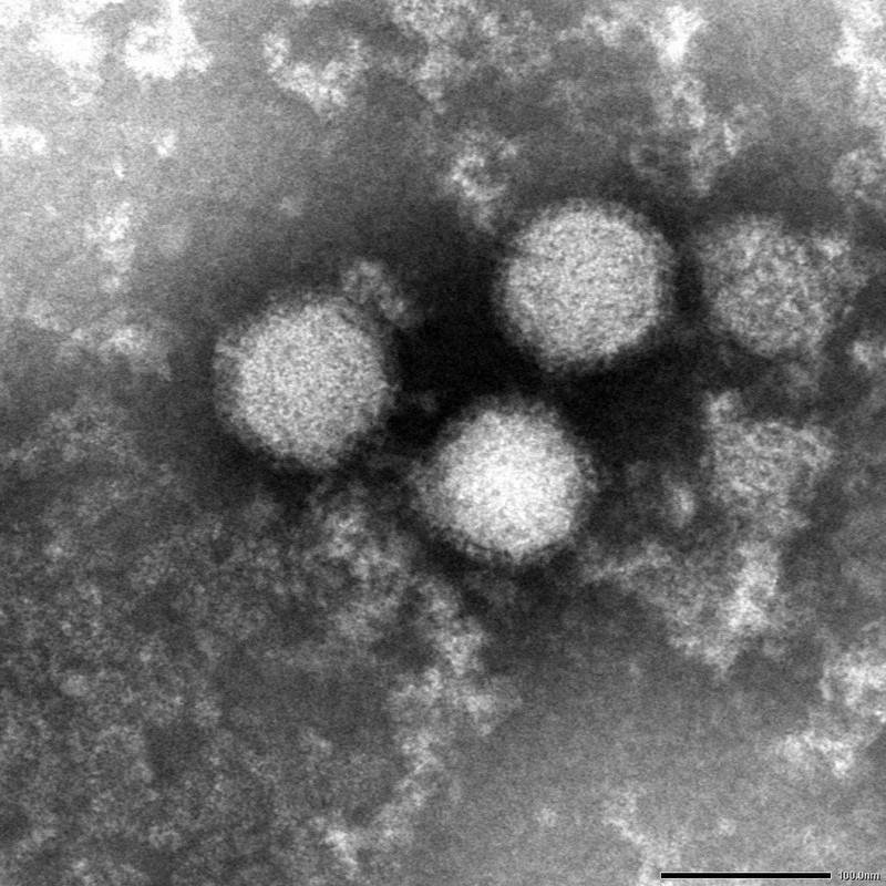 マダニ感染症「SFTS」患者数が過去最多　国内致死率は27％