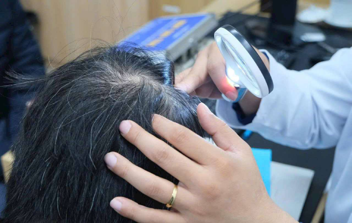 Bạc tóc ở tuổi 20, có nguy hiểm?