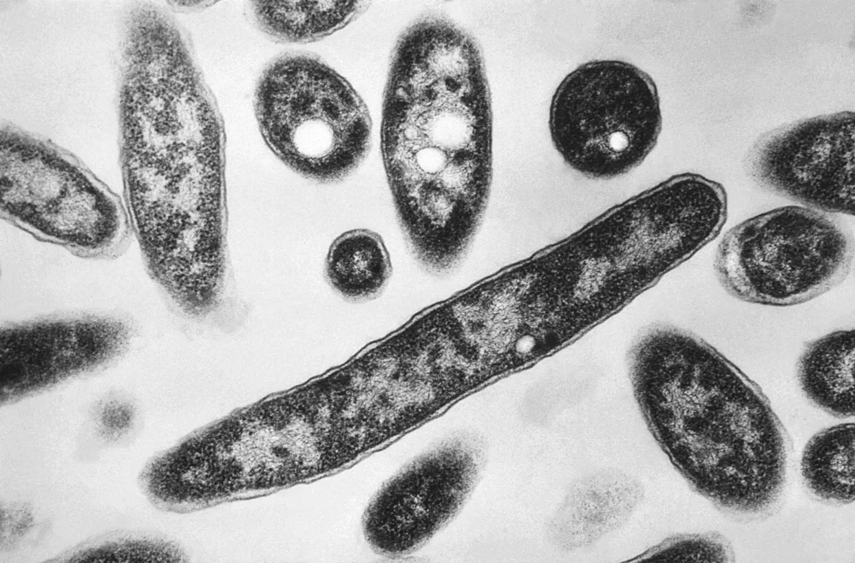 What to know about Legionnaires' disease, which has sickened dozens in New York City