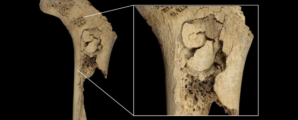Human Bones Reveal Evidence of One Horrifying Cannibalistic Feast