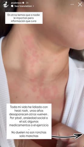 Instagram | Ana Brenda Contreras