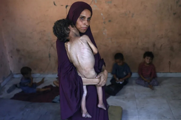 NGO says starving Gaza children too weak to cry