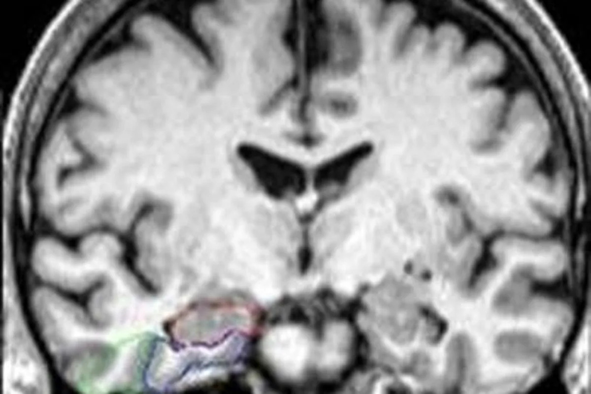 Natural compound found in popular hot drink could protect brain against Alzheimer’s, study finds